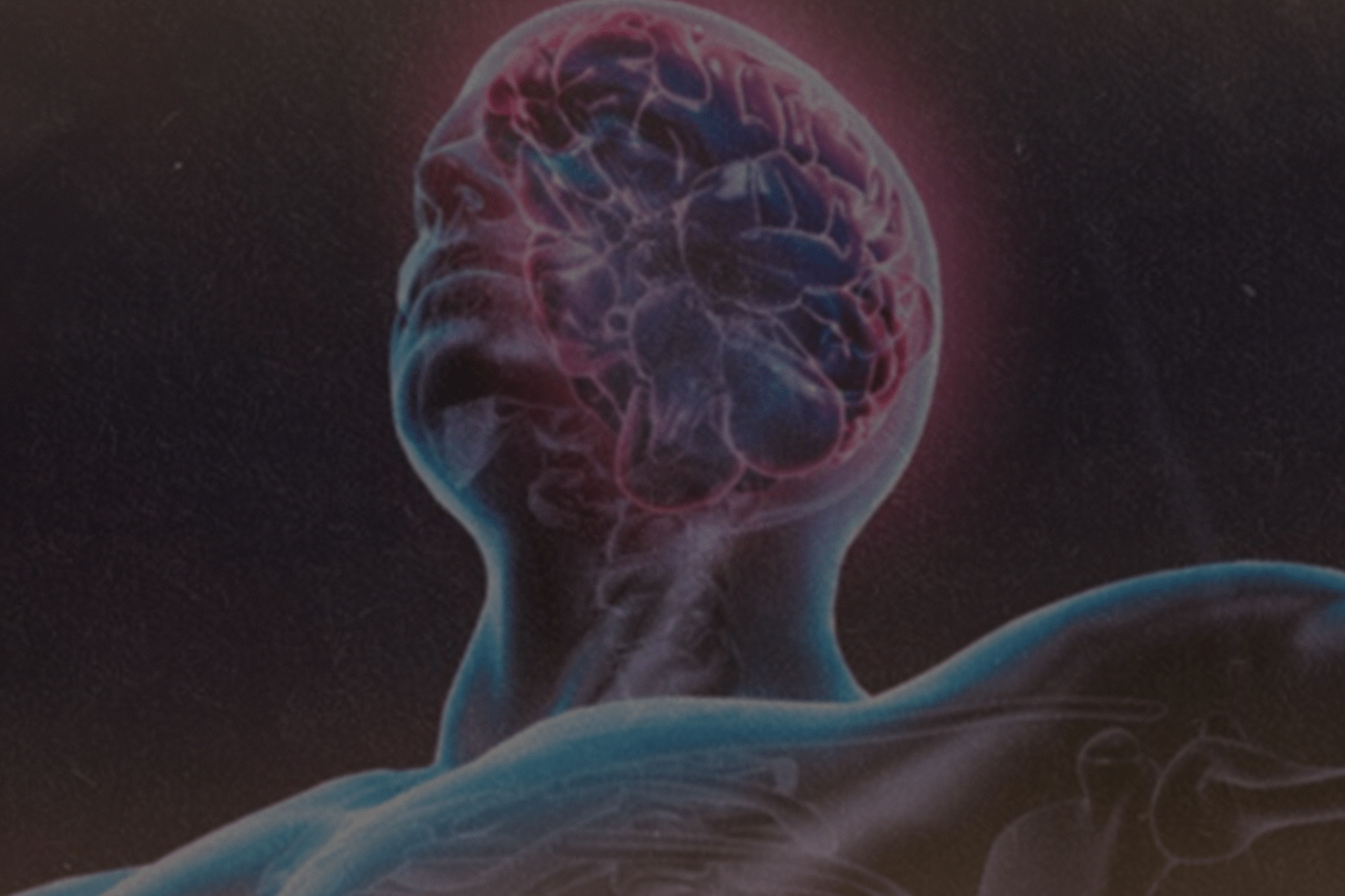 Entenda o que são doenças psicossomáticas e quais são os tipos mais comuns