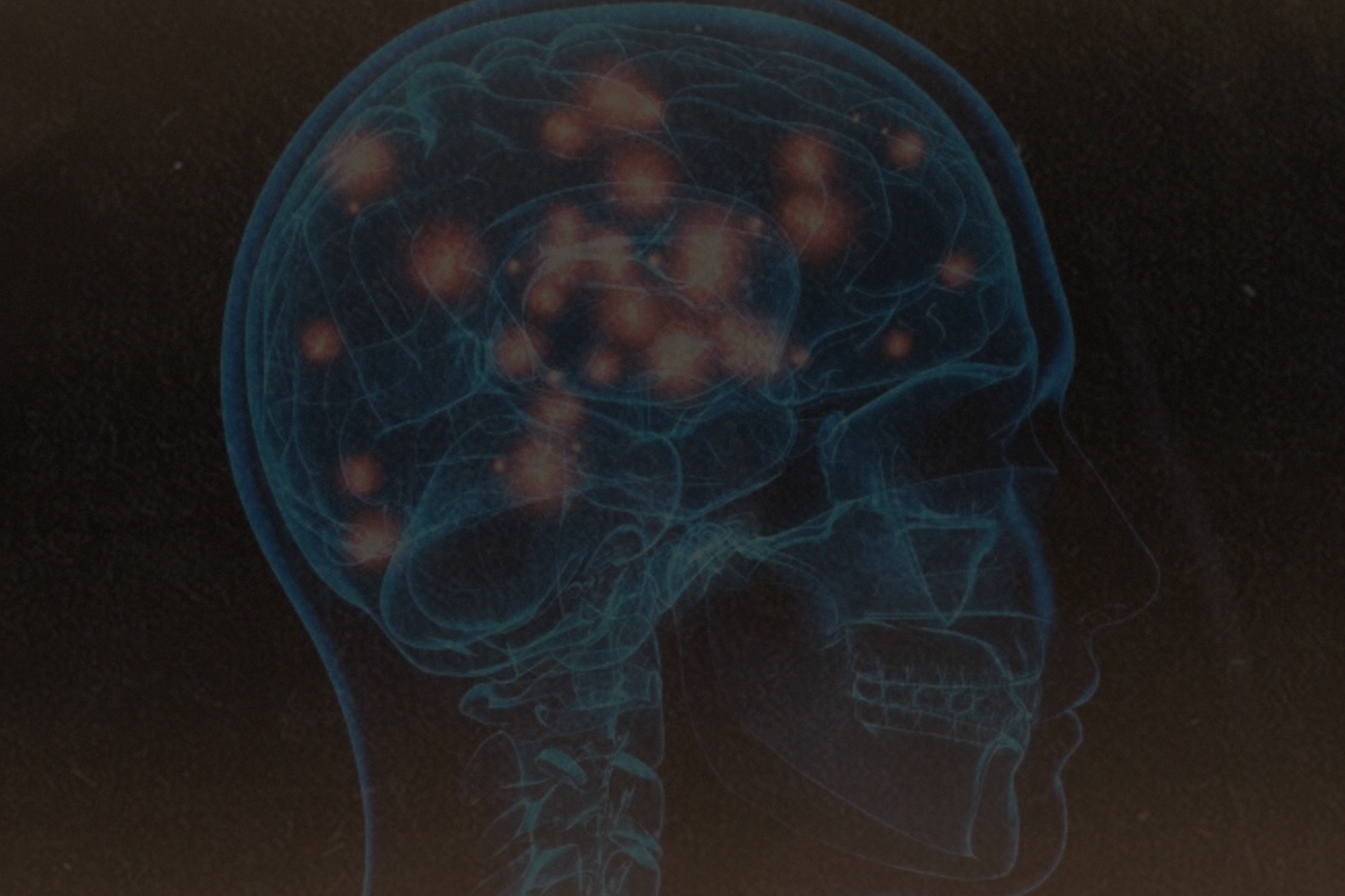 Dicas para aumentar a serotonina e dopamina no corpo